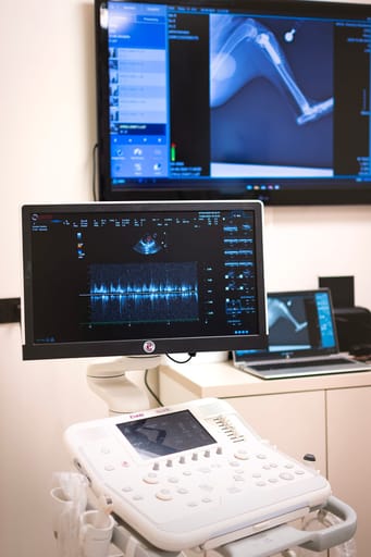 Rentgenový snímek na monitoru a ultrazvuk s dopplerovským vyšetřením